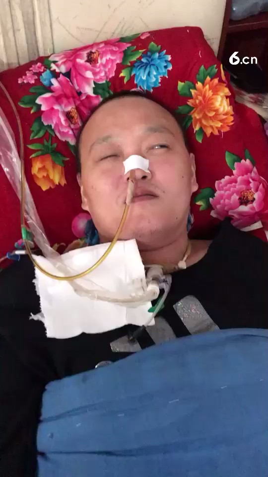 一会去除胃管 尿管和气管插管啦