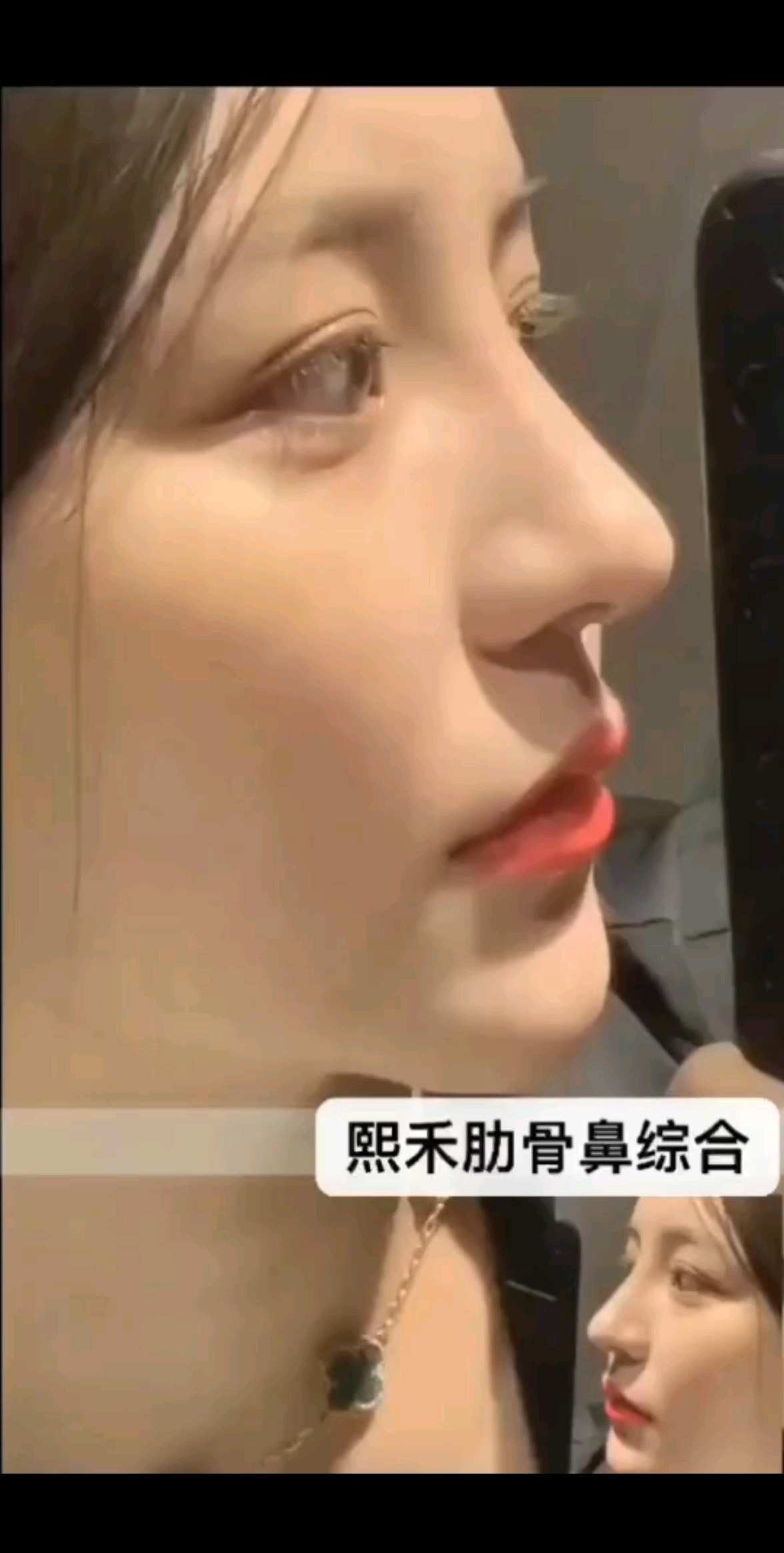 安好