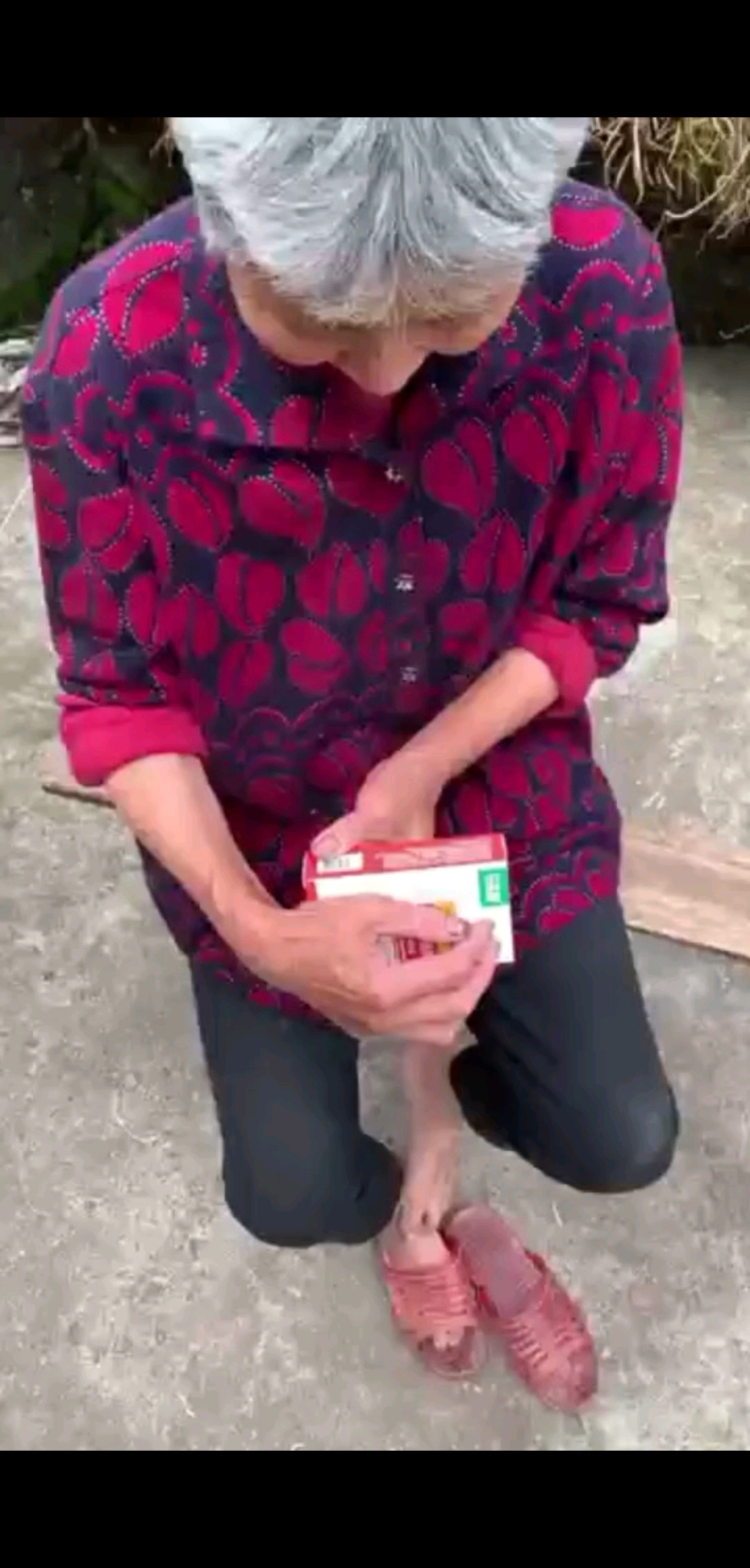 灰指甲这下好了。今森